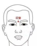 印堂穴