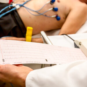 Electrocardiogram (ECG): Normal Range, Types, Precautions & FAQs