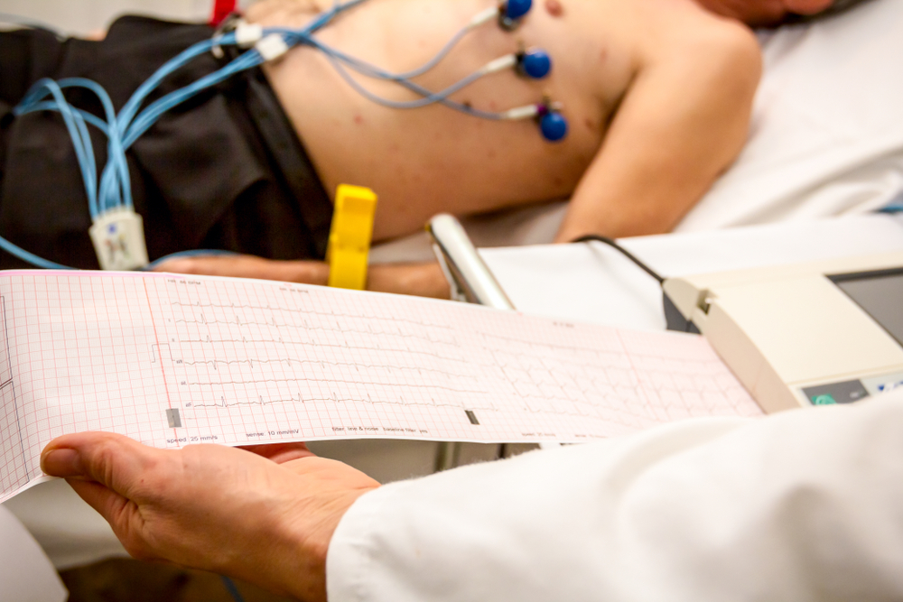 【心電圖】ECG是什麼？如何監測心跳？一文教你讀懂心電圖！