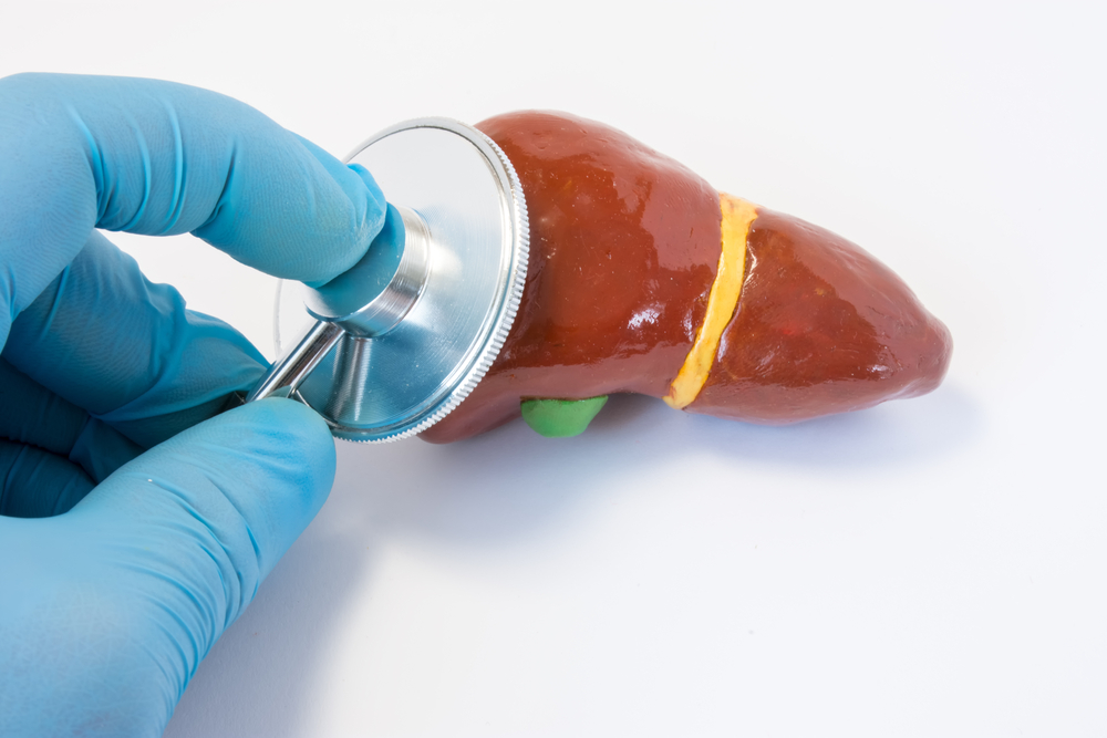 Liver Function Test (LFT): Test List, Results, Pricing & FAQs