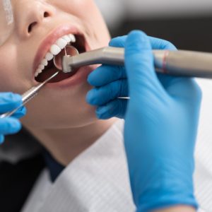 【洗牙】幾耐應洗一次？有何作用及注意事項？（附2023年價錢參考）