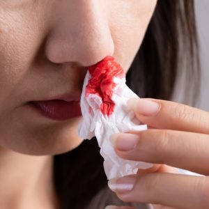 【流鼻血】怎麼辦？了解原因、正確止血方法與何時求醫