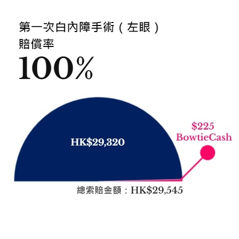 Bowtie真實客戶索償個案-白內障手術