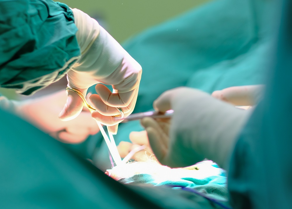 【小腸氣手術費用】了解2025年最新價錢 + 保險賠償須知