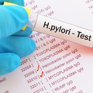 Helicobacter Pylori Test: How breath test works? Results & Pricing