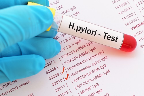 Helicobacter Pylori Test: How breath test works? Results & Pricing