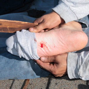 【破傷風】可以透過傷口傳染！了解治療及預防方法