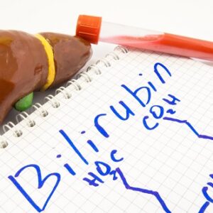 Total Indirect Bilirubin