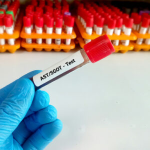 Meaning of Aspartate Aminotransferase (AST/SGOT)