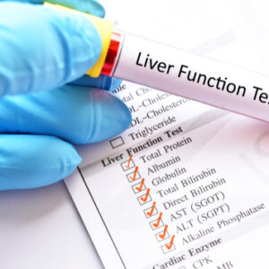 Relationship between SGPT and ALT