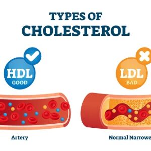 LDL Cholestereol