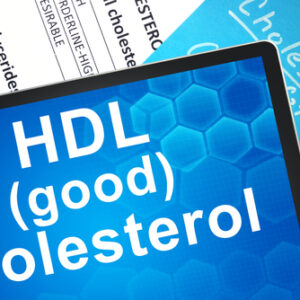 HDL Cholesterol