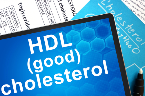 HDL Cholesterol