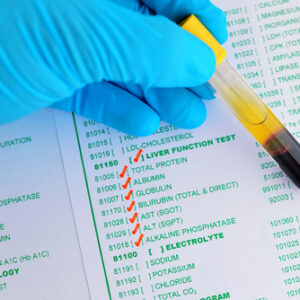 Renal Function Profile