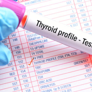 Thyroid Function Profile