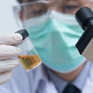 Urine Analysis