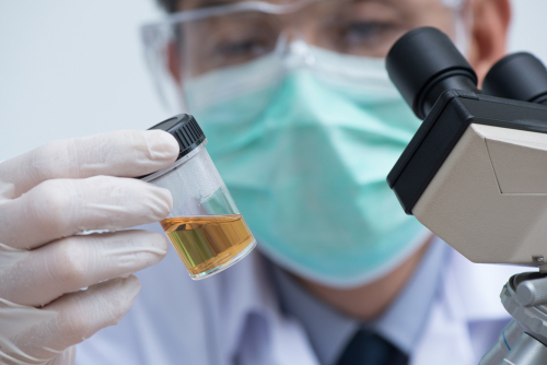 Urine Analysis
