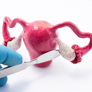 【卵巢癌】了解治療方案及費用 + 保險理賠