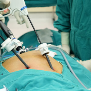 膽石手術/膽囊切除︰腹腔鏡 vs 開腹式費用 + 保險理賠