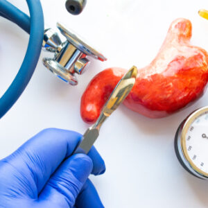 【縮胃手術】誰適合做？手術價錢、後遺症、自願醫保包唔包？