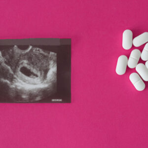 【終止懷孕】私家醫院及家計會2025年收費、手術流程及須知