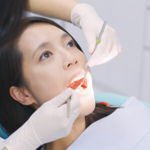 自願醫保包牙科保障？