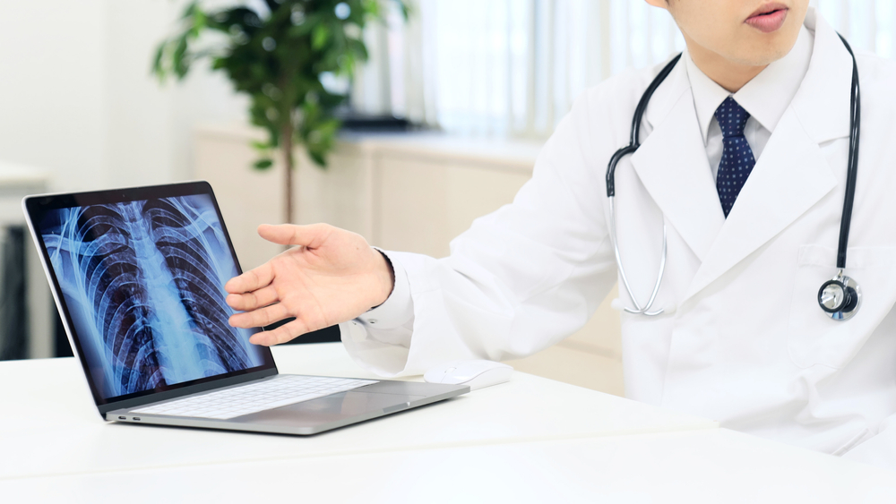 【肺癌治療】邊種方法成功率最高？比較最新治療方案及費用