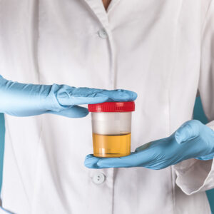 【驗尿】驗到什麼？正確方法、流程、報告解讀（附香港價錢）