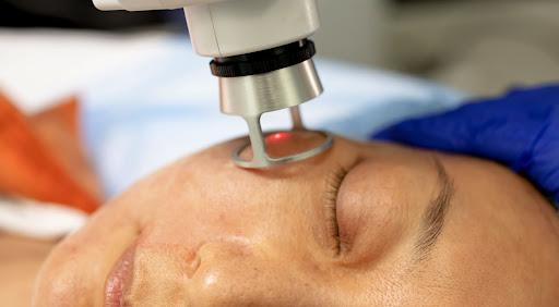 色斑越來越深，想一次K.O.？一文了解皮秒去斑療程究竟有幾勁？