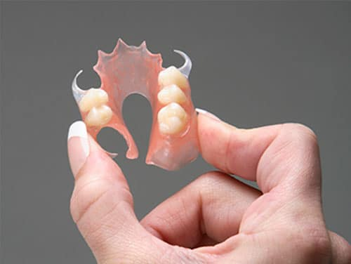 彈性牙托（Flexible denture）