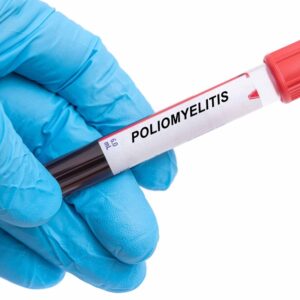 【小兒麻痺症】會遺傳嗎？了解成因、傳播途徑、症狀及預防方法