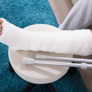 打石膏後有甚麼要注意？教你上、下肢復健運動！