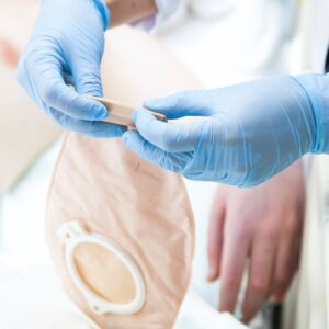 一文看清造口種類、併發症、護理重點