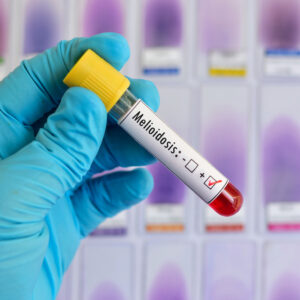 【類鼻疽】死亡率有幾高？哪裡是傳播重災區？詳解症狀及治療方法！