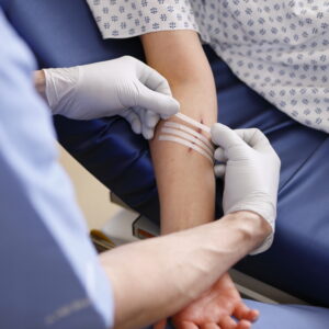 【縫針】適合甚麼類型的傷口？術後不能吃什麼？