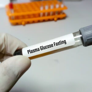 【空腹血糖】有甚麼因素會影響測試？如何解決？