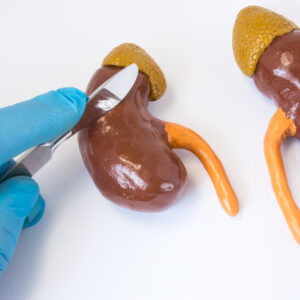 腎癌手術：腎臟切除術（Nephrectomy）