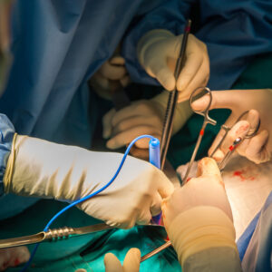 腎臟切除手術費用2024