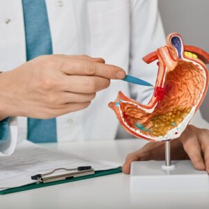 胃癌手術及治療方法