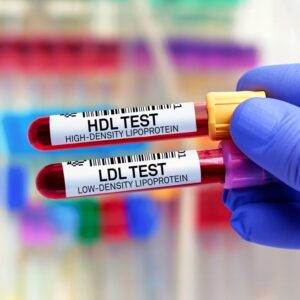 低密度膽固醇(LDL)=壞膽固醇？正常值是多少？即看改善方法！