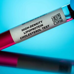 高密度膽固醇（HDL）正常值是多少？即看提升方法與飲食建議