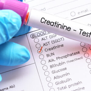 【肌酸酐】是什麼？指數正常值是多少？認識過高原因＋改善方法！