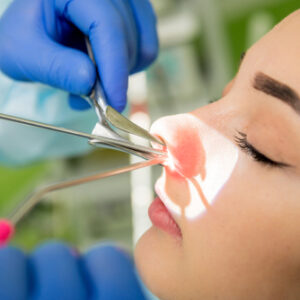 【鼻竇炎手術費用2025】公私營醫院收費參考