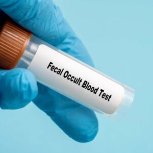 大便隱血測試準確嗎？即睇原理、目的、程序及注意事項！