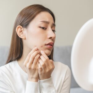 【石頭瘡】即睇成因、症狀、檢測、處理及預防方法