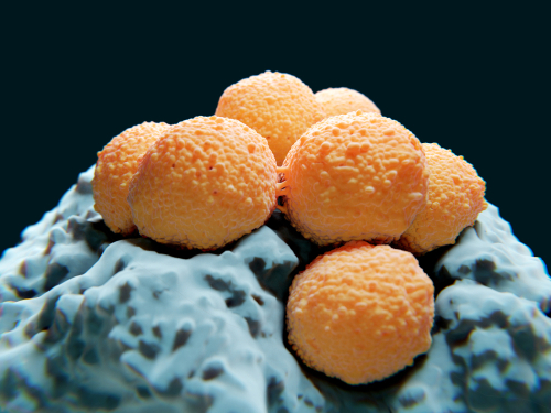 【食肉菌】手指感染要截肢？了解症狀、來源與治療