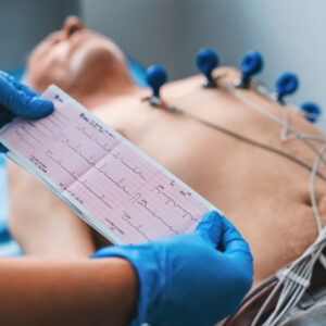 What is an ECG? How to monitor heart rate? A guide to understanding electrocardiograms!