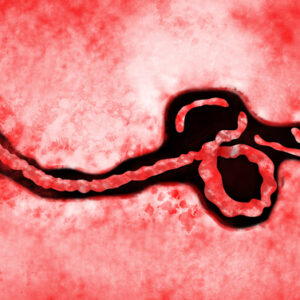 【伊波拉病毒】了解症狀、死亡率、疫苗及保險保障