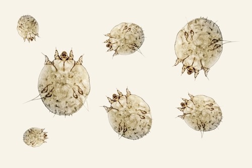 【疥瘡】即睇症狀、成因、治療及預防方法