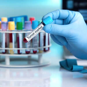 2025 政府公立醫院腫瘤科門診排期要等幾耐？如何預約？